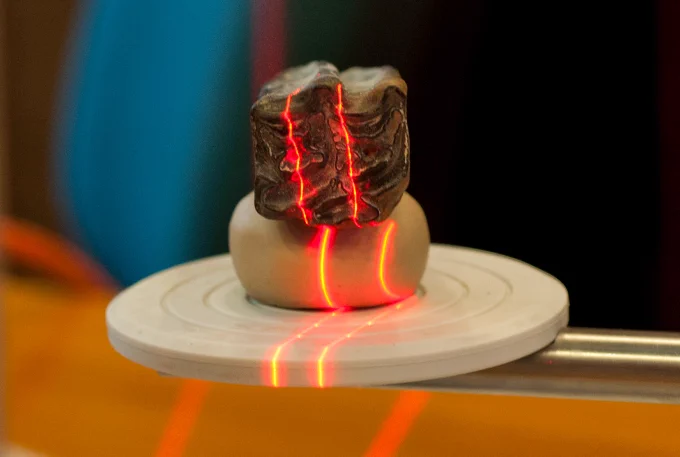close up of hands in a lab setting working on what appears to be very tiny teeth set in a jaw made of a waxy substance