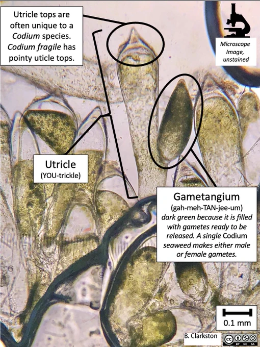 A cross-section of Codium fragile showing utricles and gametangia (singular: gametangium). The gametangia are darker green because there are many gametes densely packed inside, ready to be released into the water when the top of the gametangium ruptures. A single Codium fragile seaweed makes either male or female gametes inside its gametangia. The tops of utricles are often unique to each species of Codium. Codium fragile has pointy utricle tops. The labelled parts are: Utricle (YOU-trickle) and Gametangium (gah-meh-TAN-gee-um). The image has been taken with a microscope and the colours are natural. Scale bar = 0.1mm.