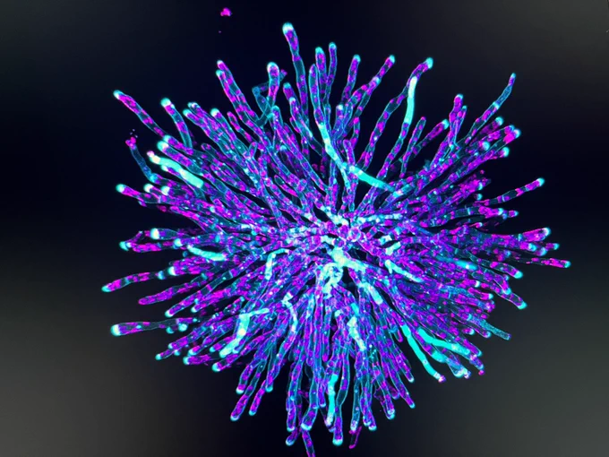 A fluorescent microscope image of a filamentous baby algae. It looks like a beautiful 1000 armed star with turquoise colored cell outlines (filaments are lines of connected cells) punctuated by magenta dots (the chloroplasts).