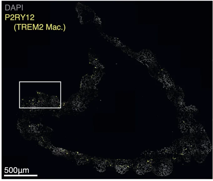 Microscopy image showing the presence of a P2RY12 expressing macrophages in the yolk sac