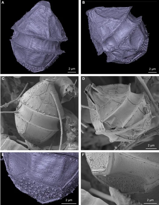 Theca shape and ornamentation of Ensiculifera tyrrhenica as visualized from vEM data compared to topography SEM analysis. 