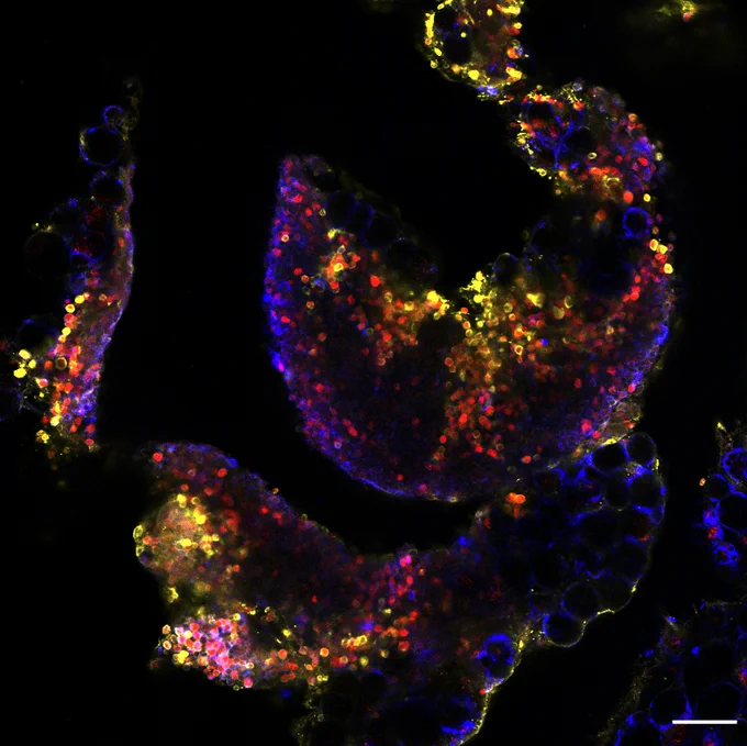 Confocal microscopy image of a Fat associated lymphoid cluster 