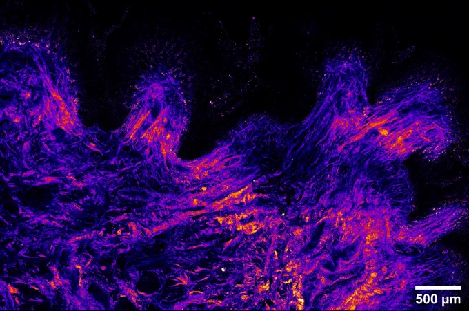 SHG image of stacked collagen with scale bar of 500 microns showing intensity and fibers in all directions. 