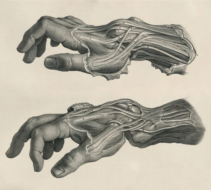 Image: Plate illustrating relative hand and wrist position in the Colles (top) vs Smith (bottom) fracture. From On Dislocations and Fractures by Joseph Maclise (London, 1859)
