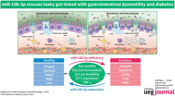 https://onlinelibrary.wiley.com/doi/full/10.1002/ueg2.12463 
https://www.gastrojournal.org/article/S0016-5085(21)00001-9/fulltext
https://www.gastrojournal.org/article/S0016-5085(21)00465-0/fulltext