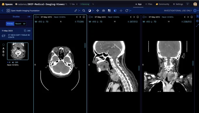 Spaces webpage of OHIF Medical Imaging Viewer