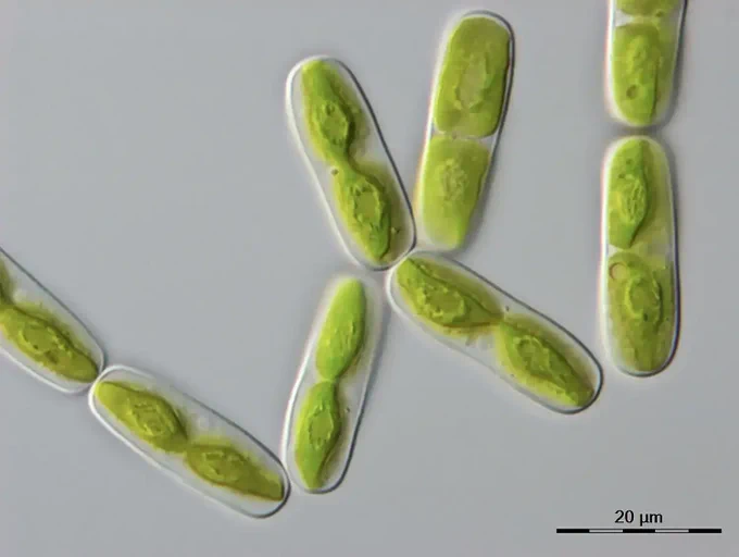 Image: Microscope image of one of the closest algal relatives of land plants, a single-celled alga called Mesotaenium endlicherianum (20 micrometres corresponds to 0.02 millimetres). Credit: Tatyana Darienko