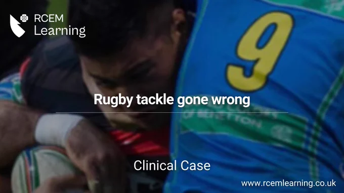 ID: RCEMLearning Logo in the top left corner. There is a shield and a small rose, all in white

A picture of a person in a rugby tackle (their head between two people). 

Alt Text: Rugby Tackle gone wrong 
Clinical Case