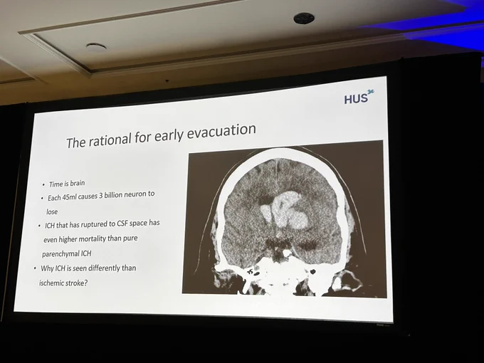 The rationale for early evacuation in ICH-IVH