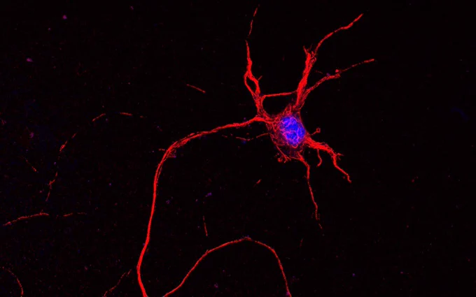 mouse spinal cord neuron