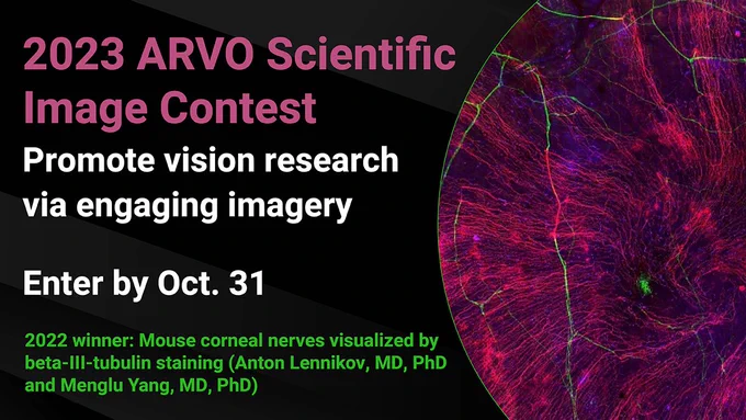 Mouse corneal nerves visualized in green by beta-III-tubulin staining