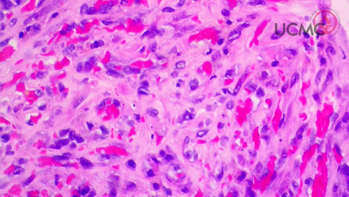 400X magnification