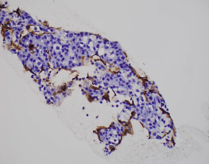 CD34