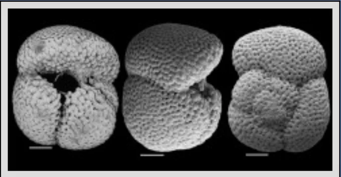 The planktic foraminifera species Globoquadrina dehiscens. Scanning electron images of a specimen. From Lam and Leckie, 2020, Micropaleontology