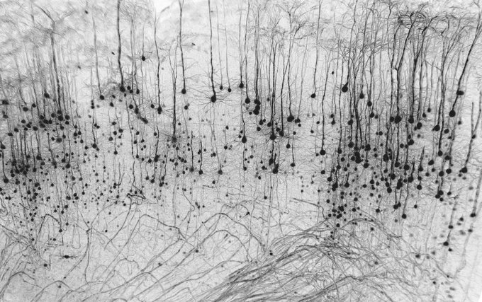 Neuronal forest – Marko Pende, more details at: https://www.bioimagingnorthamerica.org/image-contest-2023/?image=neuronal-forest-marko-pende