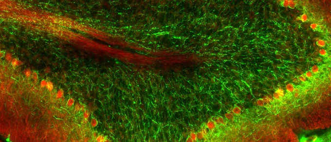 Adult mouse cerebellum with Purkinje neurons labeled in red and axons labeled in green (Image by A. Tulloch, Jaworski laboratory)