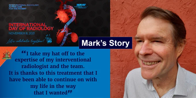 Male interventional radiology patient smiling