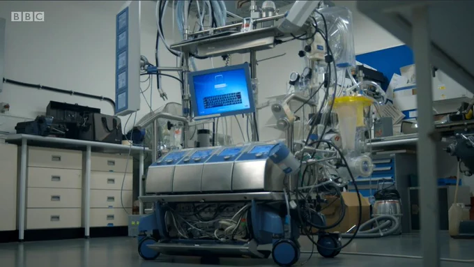 A heart-lung bypass machine. A silver frame on wheels with machines and pipes