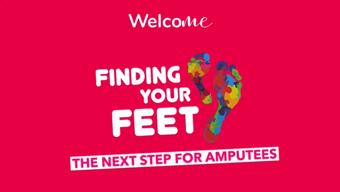 Magenta/fuchsia background. On the tope welcoMe logo in white letters. Below our logo is the Finding my Feet logo, which is 2 multicoloured feet on the right and it reads "Finding my feet" in white letters on the left. Underneath it reads "the next step for amputees"