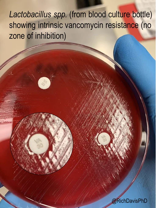 A red bacterial growth plate with two white disks stuck to it labeled "VA 30." Caption reads: Lactobacillus spp. (from blood culture bottle) showing intrinsic vancomycin resistance (no zone of inhibition)
