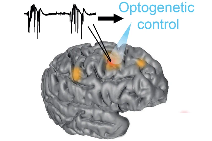 Optogenetic control of chronic epilepsy, using brain-machine interfaces