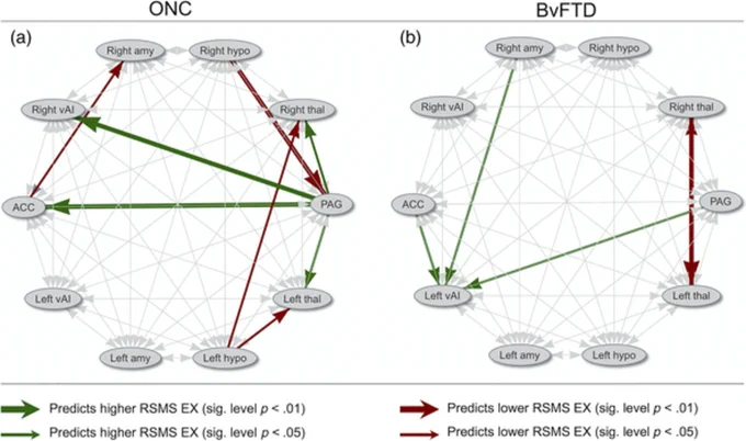 Schematic illustration of effective node connections that with a significance level of p < .05 or p < .01 predicted higher or lower RSMS EX scores, calculated separately for ONC and bvFTD patients.