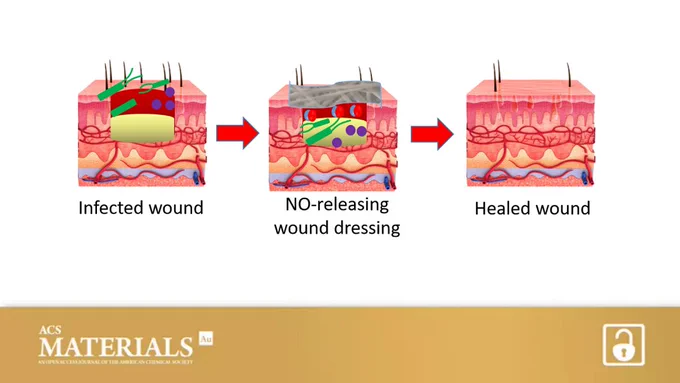 Antimicrobial nitric oxide releasing electrospun dressings for wound healing applications

Open access in ACS Materials Au
