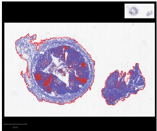 What is the definition of “Next-generation diagnostic pathology”.
 
It will be a combination of Pathology morphological and biological information, medical examination, imaging features, and clinical information.