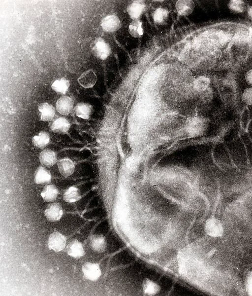 Electromicrograph of a phage