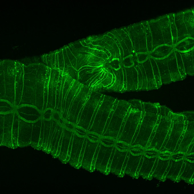 Antibody against acetylated tubulin labels the nervous system.  Ventral nerve cord is ladder-like structure down middle of worm. This worm has 2 VNCs!