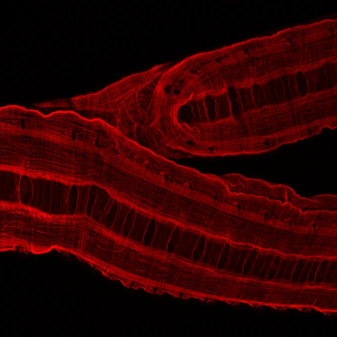 Phalloidin stains the muscle. 