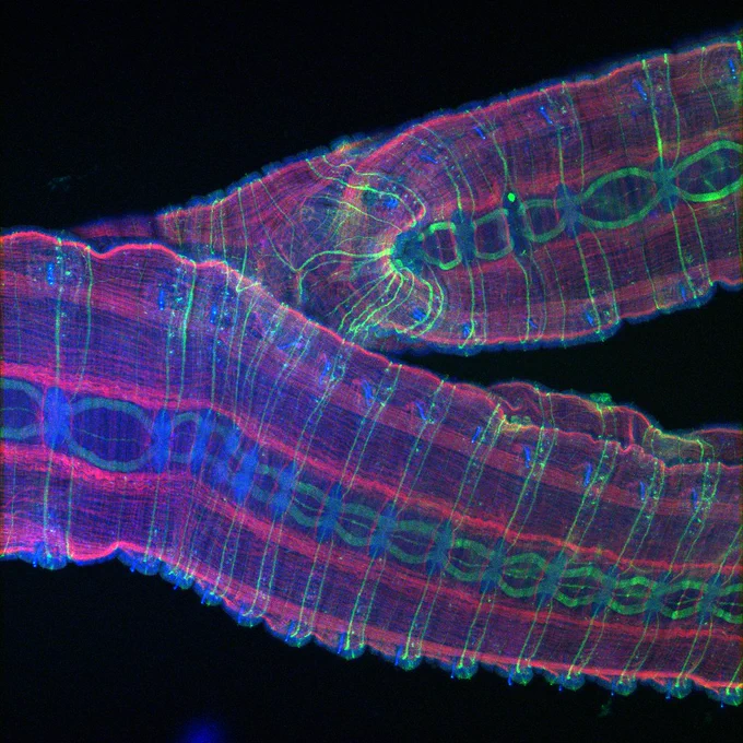 This is an overlay of the nervous system, muscle, and nuclei (labelled in blue).