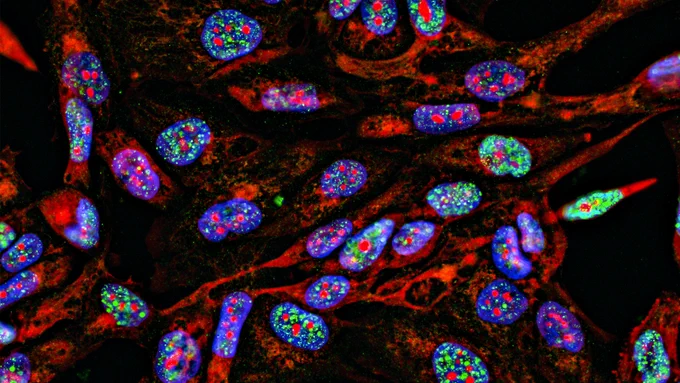 Why utilize high content screening over traditional microscopy?