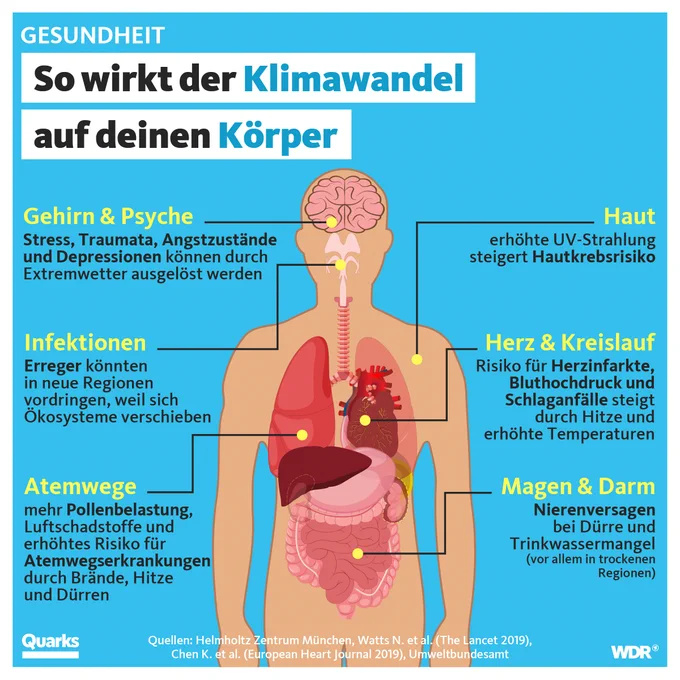 Titel: So wirkt der Klimawandel auf deinen Körper. Man sieht einen Körper mit verschiedenen Organen, die beschriftet sind. z.B. Gehirn & Psyche: Stress, Traumata, Angstzustände und Depressionen können durch Extremwetter ausgelöst werden. Atemwege: stärkere Pollenbelastung, mehr Luftschadstoffe und erhöhtes Risiko für Atemwegserkrankungen durch Hitze, Dürren und Brände. Quellen u.a.: Helmholtz Zentrum München, ...