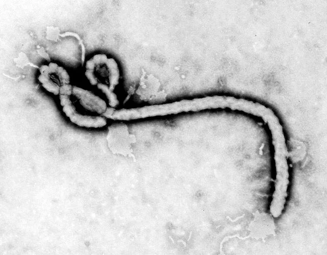 Ebola virus