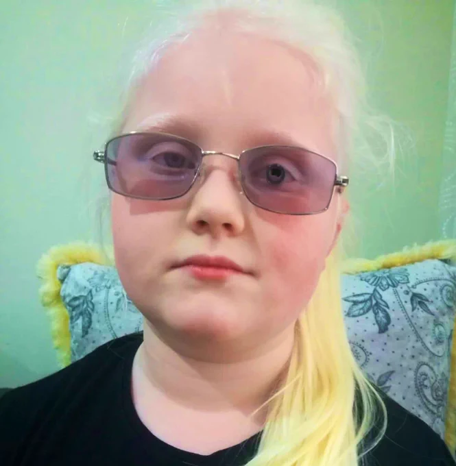 MiniTelescopicGlasses are invisible from out. 
You reach a 20/20 vision with this custom-made spectacle, reach driving level