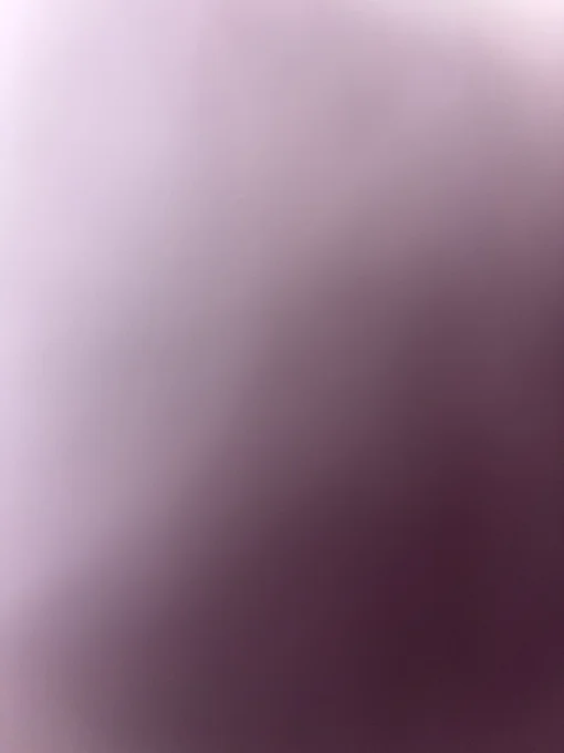 This image is very blurred and shows dark with some light at the edge. Nothing can be seen