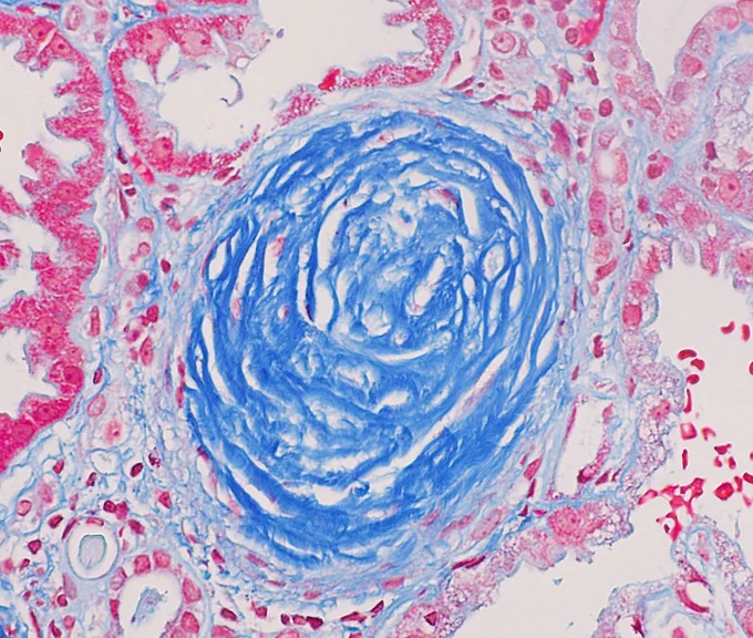 Trichrome 400x