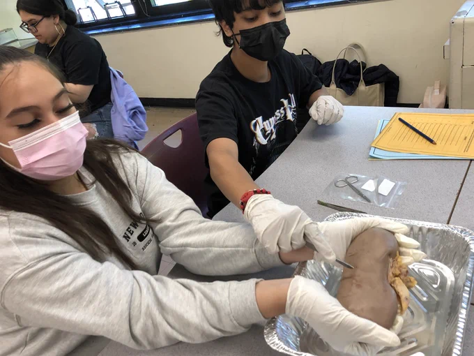 kidney