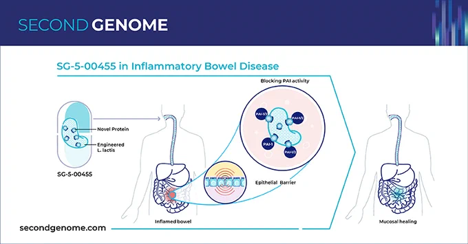 By blocking plasminogen activator inhibitor in the gastrointestinal mucosa, SG-5-00455 has the potential to directly target mucosal healing in patients with inflammatory bowel disease (IBD). To learn more, go to secondgenome.com 