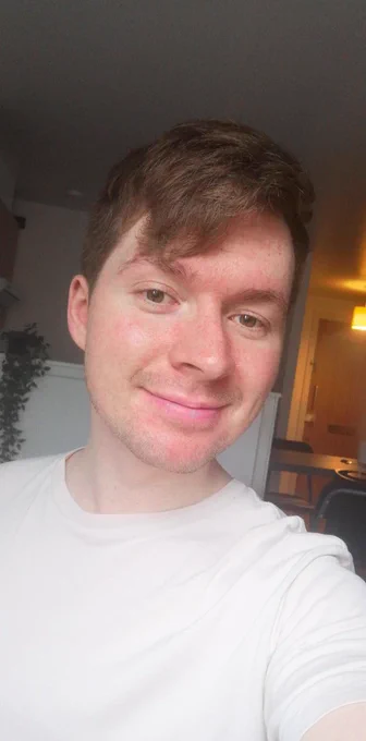 Sam is a white male in his twenties with a skin condition. Here, he smiles at the camera. 