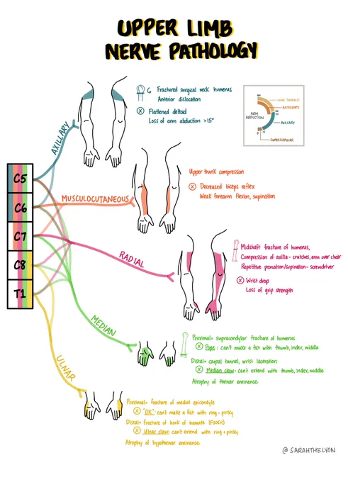 Image describing upper limb nerve pathologies including axillary, musculocutaneous, radial, median, ulnar nerves.