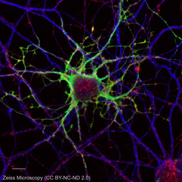 Confocal fluorescence microscopy image of a neuron. 