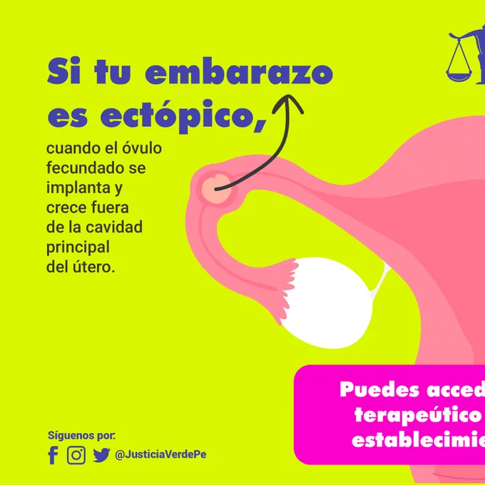 Si tu embarazo es ectópico, cuando el óvulo fecundado se implanta y crece fuera de la cavidad principal del útero, puedes acceder a un aborto terapéutico seguro en un establecimiento de salud.