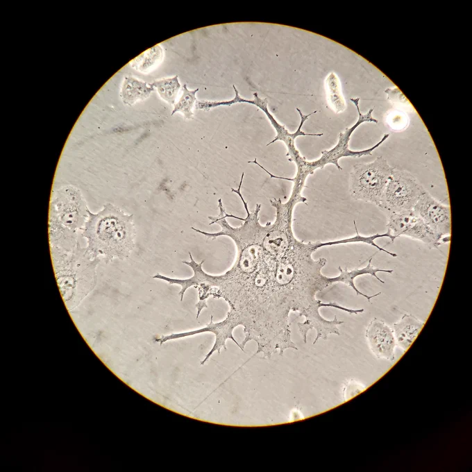 A multinucleated cell under a light microscope that appears neuronal-like. A few branches have made connections with neighboring cells.