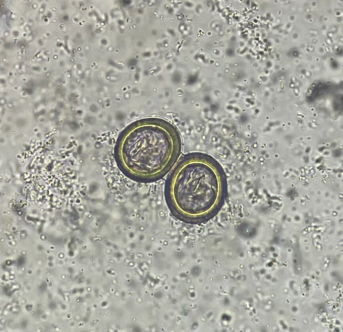 Microscope image of two Taenia (tapeworm) eggs