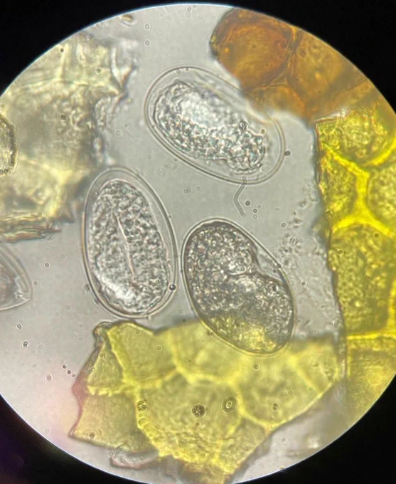 Microscope image of three hookworm (Ancylostoma) eggs