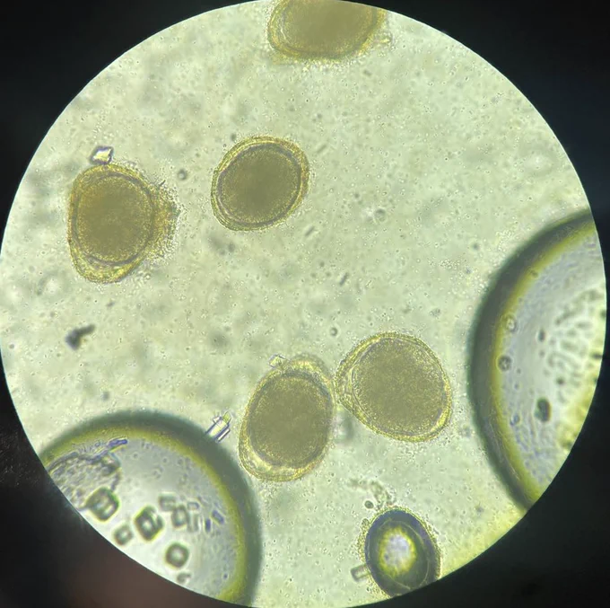 Microscope image of four Toxocara (roundworm) eggs