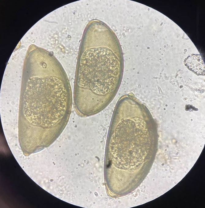 Microscope image of three Oxyurida (pinworm) eggs