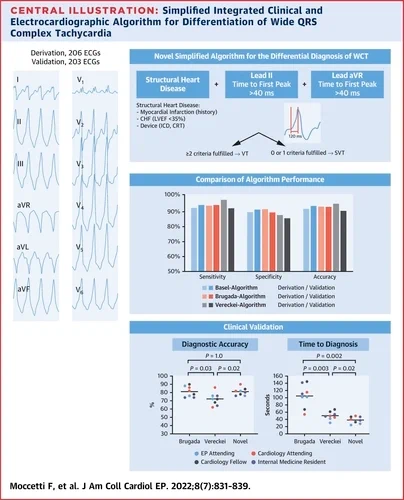 Simplified Algorithm for differentiation of wide QRS complex tachycardia! 